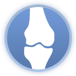Osteoarthritis 