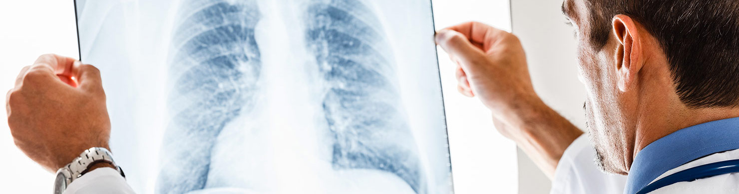 Learn More About COPD (Lung Disease)